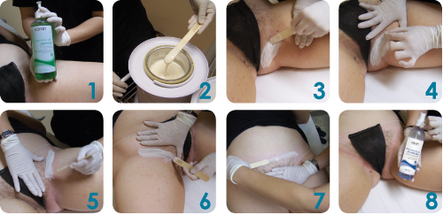 Advanced Rejuvenanting Concepts