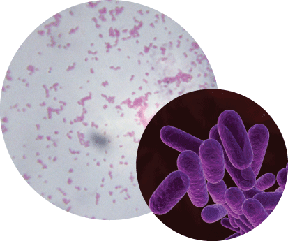 bacteria