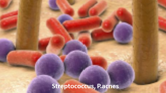 Bad Bacteria